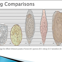 Schistosomiasis egg comparison
