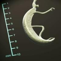 Schistosomiasis worm pair