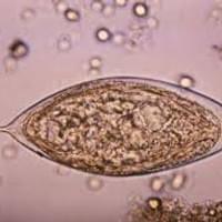 Schistosomiasis haematobium egg