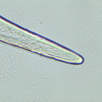 Schistosomiasis worm in urine sample