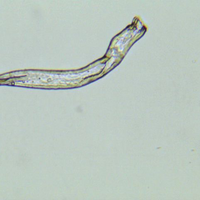 Male Schistosomiasis worm Male Schistosomiasis worm