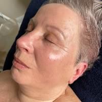 The Beautiful You Co, Little Tey, Essex, luxury beauty skin treatments The Beautiful You Co, Little Tey, Essex, luxury beauty skin treatments