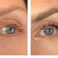 The Beautiful You Co, Little Tey, Essex, luxury beauty eye treatments The Beautiful You Co, Little Tey, Essex, luxury beauty eye treatments