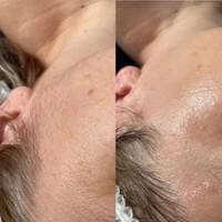 The Beautiful You Co, Little Tey, Essex, luxury beauty skin treatments The Beautiful You Co, Little Tey, Essex, luxury beauty skin treatments