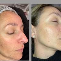 The Beautiful You Co, Little Tey, Essex, luxury beauty skin treatments The Beautiful You Co, Little Tey, Essex, luxury beauty skin treatments