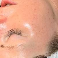 The Beautiful You Co, Little Tey, Essex, luxury beauty skin treatments The Beautiful You Co, Little Tey, Essex, luxury beauty skin treatments