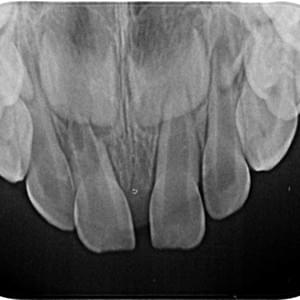 Radiografía oclusal Radiografía oclusal