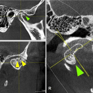 Scanner CBCT ATM Scanner CBCT ATM