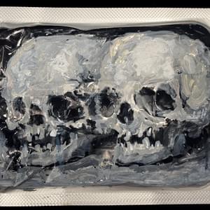 2 skeletons on Pill case 2 skeletons on Pill case