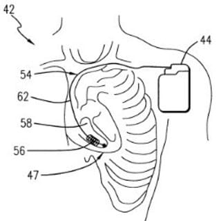 Section image