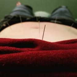 Abdominal Acupuncture Abdominal Acupuncture