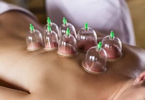 Cupping Therapy (Please text to 323-416-9092 to make appointment)