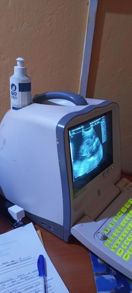 Weekly Ultrasound (ultra scan)