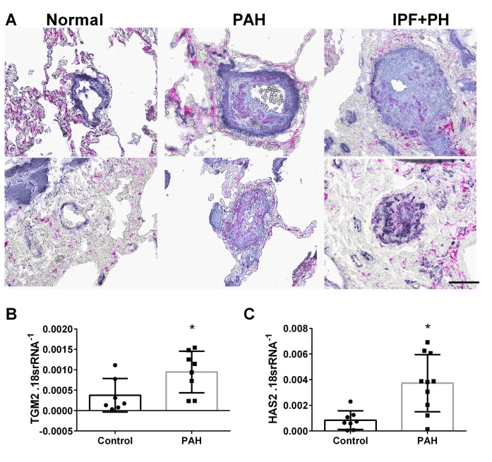 lung IHC for TGM2 and SMA (panel A) and expression levels of tgm2 and Has2 lung IHC for TGM2 and SMA (panel A) and expression levels of tgm2 and Has2