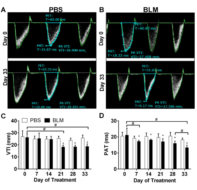 Doppler echo from a PBS (panel A) or BLM (panel B) treated mouse. Panel C: VTI and Panel D: PAT from PBS or BLM treated mice obtained on days 0, 7, 14, 21, 28 and 33. Doppler echo from a PBS (panel A) or BLM (panel B) treated mouse. Panel C: VTI and Panel D: PAT from PBS or BLM treated mice obtained on days 0, 7, 14, 21, 28 and 33.