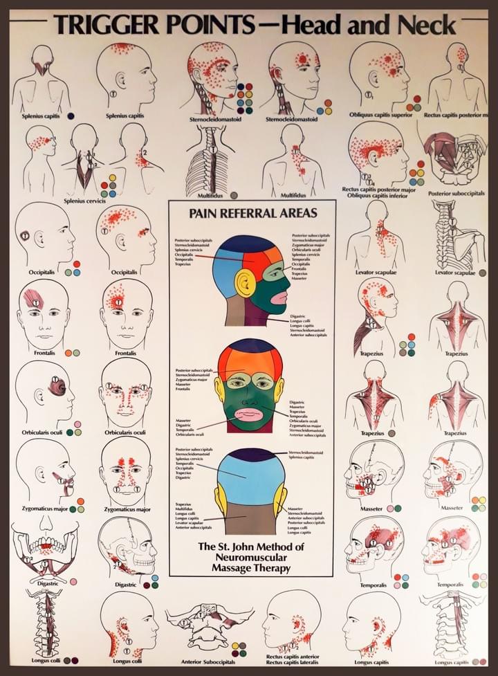 Neuromuscular therapy trigger point chart Neuromuscular therapy trigger point chart