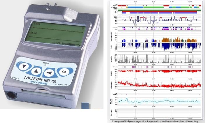 Movilsalud, Electroencefalograma en domicilio Movilsalud, Electroencefalograma en domicilio