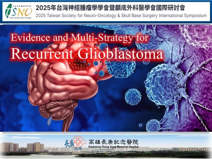 腦瘤、神經外科、莊銘榮、高雄長庚、清醒手術、膠質瘤、島葉 腦瘤、神經外科、莊銘榮、高雄長庚、清醒手術、膠質瘤、島葉