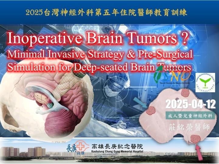腦瘤、顱底、神經外科、莊銘榮、高雄長庚 腦瘤、顱底、神經外科、莊銘榮、高雄長庚