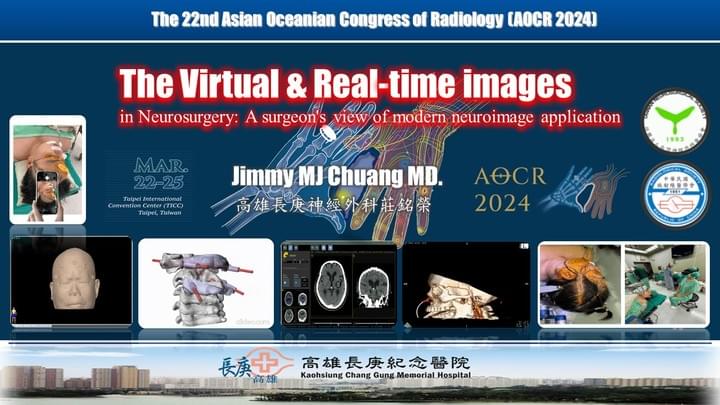 莊銘榮、高雄長庚、腦瘤手術、顱底手術、神經外科、虛擬實境 莊銘榮、高雄長庚、腦瘤手術、顱底手術、神經外科、虛擬實境