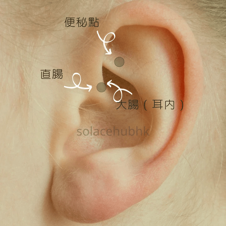 耳穴療法 Ear seeds therapy 耳穴療法 Ear seeds therapy
