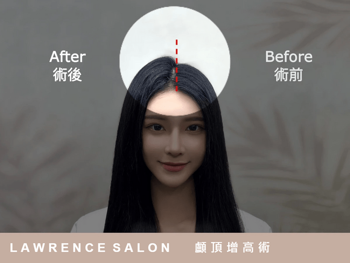 接髮 接髮推薦 接髮價格 接髮費用 接髮dcard 接髮推薦dcard 接髮優點 接髮缺點 接髮ptt 接髮推薦ptt 接髮店家 接髮過程 接髮注意事項 接髮注意事項 接髮方式 接髮品牌 接髮好不好 接髮優缺點 接髮前後對比 接髮便宜 接髮種類 接髮失敗 接髮後悔 接髮材料 接髮差異 接髮是否有害 接髮前準備 接髮折扣 接髮好處 接髮後如何護理 接髮選擇 接髮技術 接髮怎麼辦 頭髮剪壞怎麼辦 頭髮漂壞怎麼辦 頭髮染壞怎麼辦 頭髮燙壞怎麼辦 頭髮過渡期 接髮型錄 接髮經驗 接髮問題 接髮影片 接髮常識 接髮和染髮哪個傷害大 接髮種類推薦 接髮怎麼拆 接髮維持時間 接髮可以維持多久 接髮要多長時間 接髮後洗頭注意事項 接髮剪髮方法 接髮哪家好 接髮產品推薦 接髮的好處和壞處 接髮髮型設計 接髮有多少種類 接髮價格差在哪 接髮翻新 接髮比較好的品牌 接髮和纏髮哪個好 接髮護理技巧 接髮效果怎麼樣 接髮美髮師推薦 接髮戴法 接髮後梳理技巧 接髮真的好看嗎 接髮可以燙嗎 接髮可以接捲的嗎 自然捲可以接髮嗎 接髮刷卡 接髮分期 接髮優惠 接髮需要多長時間 接髮是否會脫落 接髮會不會很假 接髮會不會很重 接髮好整理嗎 接髮好洗頭嗎 接髮會斷層嗎 接髮會損壞真髮嗎 接髮過敏反應怎麼辦 接髮會不舒服嗎 接髮會痛嗎 接髮會不舒服或痛嗎 接髮會導致頭皮問題嗎 接髮會造成頭髮稀疏嗎 接髮可以綁嗎 接髮會限制髮型嗎 接髮需要特別護理嗎 接髮怎麼洗頭 接髮可以洗頭游泳嗎 接髮效果不理想怎麼辦 接髮需要維護修整嗎 接髮會被發現嗎 接髮自然嗎 接髮師技術不好怎麼辦 接髮影響日常生活嗎 接髮會打結嗎 接髮改變髮質髮色嗎 接髮品質有問題嗎 接髮影響個人形象嗎 接髮技巧 接髮保養 接髮比較 接髮教學 接髮諮詢 接髮評價 接髮經驗  接髮專賣店 接髮材料 接髮營業時間 接髮樣式 接髮趨勢 接髮新品 接髮達人 天羽接髮 天羽pro接髮 pro接髮 6D接髮 ann接髮 h接髮 接髮好嗎 接髮拆除 台北接髮 台北接髮推薦 桃園接髮 桃園接髮推薦 新竹接髮 新竹接髮推薦 台中接髮 台中接髮推薦 彰化接髮 台南接髮 台南接髮推薦 高雄接髮 高雄接髮推薦 髮量女王術 長髮少女術 顱頂增高術 無痛挑染術 歐絲鉑原廠認證 法式接髮 微絲接髮 彩色接髮 魚線接髮 韓式接髮 訂製接髮 真人髮接髮 人工髮接髮 婚禮接髮 美髮接髮 洗髮接髮 染髮接髮 電髮接髮 剪髮接髮 網 接髮 接髮推薦 接髮價格 接髮費用 接髮dcard 接髮推薦dcard 接髮優點 接髮缺點 接髮ptt 接髮推薦ptt 接髮店家 接髮過程 接髮注意事項 接髮注意事項 接髮方式 接髮品牌 接髮好不好 接髮優缺點 接髮前後對比 接髮便宜 接髮種類 接髮失敗 接髮後悔 接髮材料 接髮差異 接髮是否有害 接髮前準備 接髮折扣 接髮好處 接髮後如何護理 接髮選擇 接髮技術 接髮怎麼辦 頭髮剪壞怎麼辦 頭髮漂壞怎麼辦 頭髮染壞怎麼辦 頭髮燙壞怎麼辦 頭髮過渡期 接髮型錄 接髮經驗 接髮問題 接髮影片 接髮常識 接髮和染髮哪個傷害大 接髮種類推薦 接髮怎麼拆 接髮維持時間 接髮可以維持多久 接髮要多長時間 接髮後洗頭注意事項 接髮剪髮方法 接髮哪家好 接髮產品推薦 接髮的好處和壞處 接髮髮型設計 接髮有多少種類 接髮價格差在哪 接髮翻新 接髮比較好的品牌 接髮和纏髮哪個好 接髮護理技巧 接髮效果怎麼樣 接髮美髮師推薦 接髮戴法 接髮後梳理技巧 接髮真的好看嗎 接髮可以燙嗎 接髮可以接捲的嗎 自然捲可以接髮嗎 接髮刷卡 接髮分期 接髮優惠 接髮需要多長時間 接髮是否會脫落 接髮會不會很假 接髮會不會很重 接髮好整理嗎 接髮好洗頭嗎 接髮會斷層嗎 接髮會損壞真髮嗎 接髮過敏反應怎麼辦 接髮會不舒服嗎 接髮會痛嗎 接髮會不舒服或痛嗎 接髮會導致頭皮問題嗎 接髮會造成頭髮稀疏嗎 接髮可以綁嗎 接髮會限制髮型嗎 接髮需要特別護理嗎 接髮怎麼洗頭 接髮可以洗頭游泳嗎 接髮效果不理想怎麼辦 接髮需要維護修整嗎 接髮會被發現嗎 接髮自然嗎 接髮師技術不好怎麼辦 接髮影響日常生活嗎 接髮會打結嗎 接髮改變髮質髮色嗎 接髮品質有問題嗎 接髮影響個人形象嗎 接髮技巧 接髮保養 接髮比較 接髮教學 接髮諮詢 接髮評價 接髮經驗  接髮專賣店 接髮材料 接髮營業時間 接髮樣式 接髮趨勢 接髮新品 接髮達人 天羽接髮 天羽pro接髮 pro接髮 6D接髮 ann接髮 h接髮 接髮好嗎 接髮拆除 台北接髮 台北接髮推薦 桃園接髮 桃園接髮推薦 新竹接髮 新竹接髮推薦 台中接髮 台中接髮推薦 彰化接髮 台南接髮 台南接髮推薦 高雄接髮 高雄接髮推薦 髮量女王術 長髮少女術 顱頂增高術 無痛挑染術 歐絲鉑原廠認證 法式接髮 微絲接髮 彩色接髮 魚線接髮 韓式接髮 訂製接髮 真人髮接髮 人工髮接髮 婚禮接髮 美髮接髮 洗髮接髮 染髮接髮 電髮接髮 剪髮接髮 網