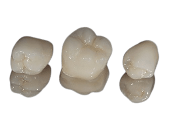 3 porcelain crowns 3 porcelain crowns