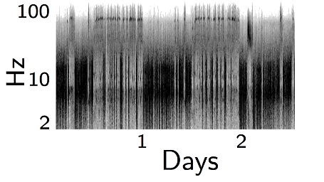 Electroencephalography Electroencephalography