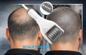 scalp micropigmentation singapore review,NPM Scalp tattoo technology and HFS hair follicle simulation technology have patent certification scalp micropigmentation singapore review,NPM Scalp tattoo technology and HFS hair follicle simulation technology have patent certification