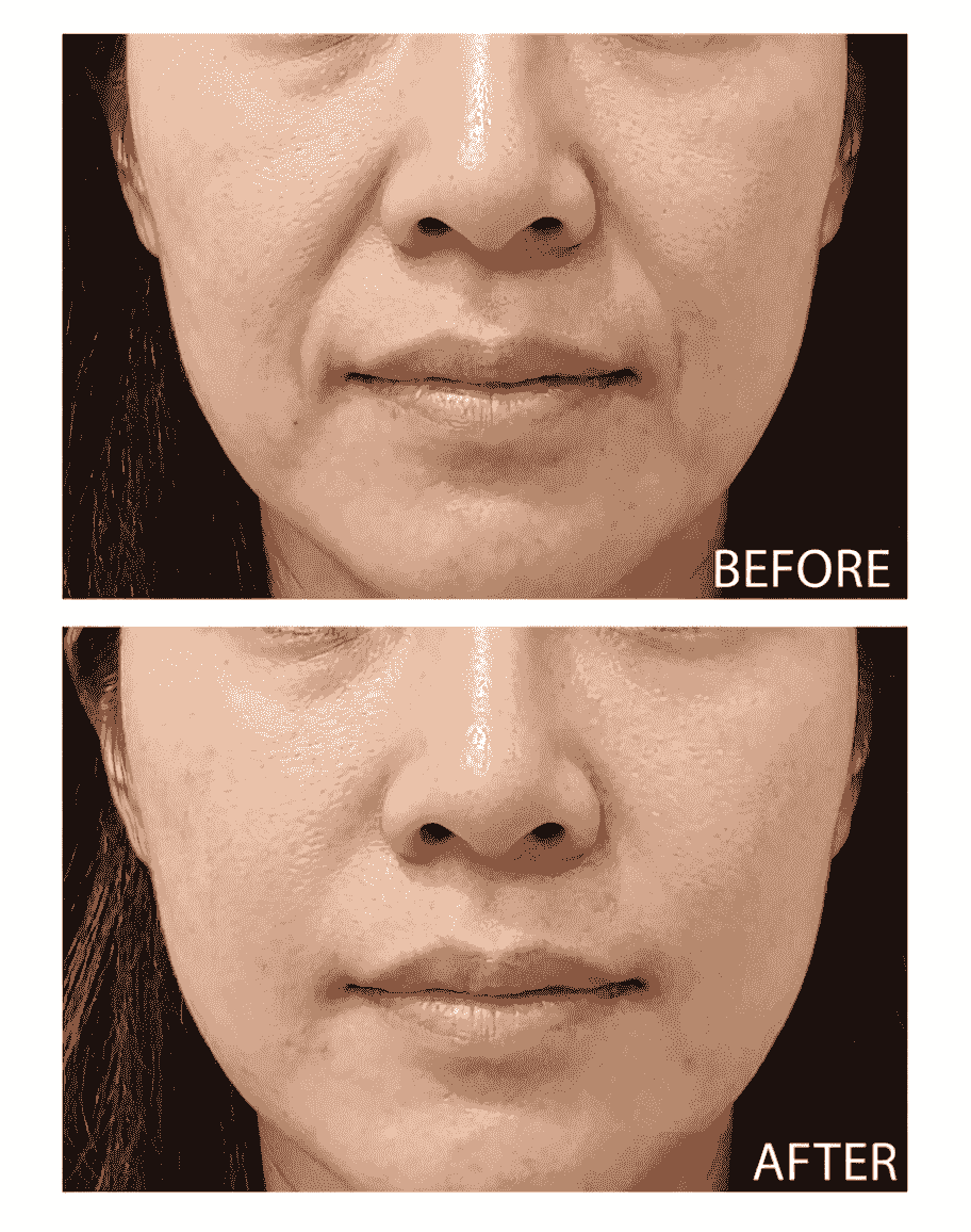 Please create a one-page official website for a Hong Kong medical beauty brand.
Brand Name: Dr.Afterhour
Brand Subname: Afternoon Care Center
Brand Type: Medical Beauty Center
Website Language: Mainly Traditional Chinese, treatment names can be kept in English.
Target Audience: Women in Hong Kong aged 25–50 who focus on anti-aging, contour enhancement, skin quality improvement, and body management.
Please establish the following sections:
1. Hero Banner
2. About Brand Introduction
3. Treatments Classification
4. Featured Treatments
5. Why Choose Us
6. Consultation CTA
7. Contact Us
Main website goal:
Build a high-end medical aesthetic brand image, clearly display treatment classifications, and guide customers to WhatsApp for inquiries and appointment assessments.