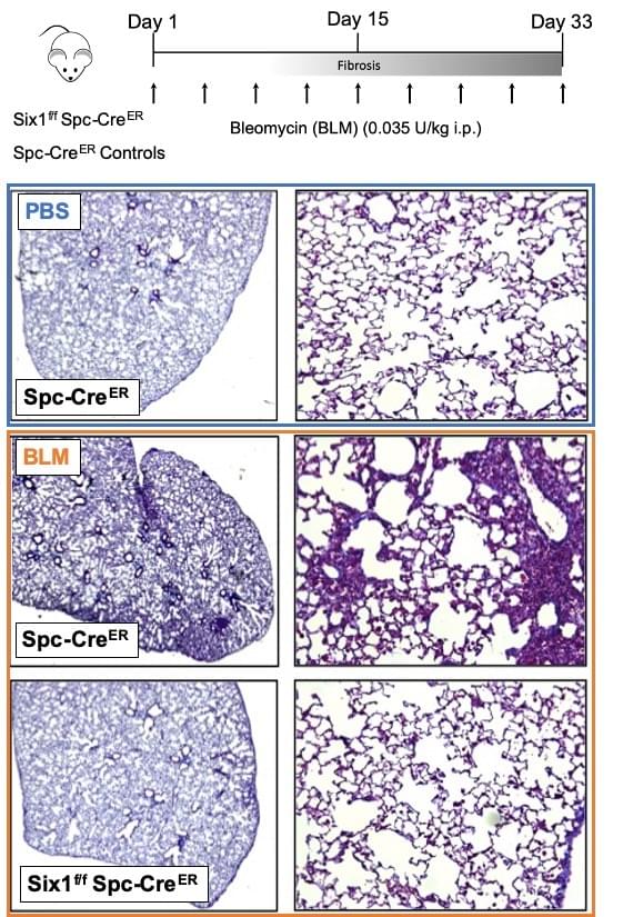 Six1 flox Spc Cre mice have protection against lung fibrosis by histology Six1 flox Spc Cre mice have protection against lung fibrosis by histology