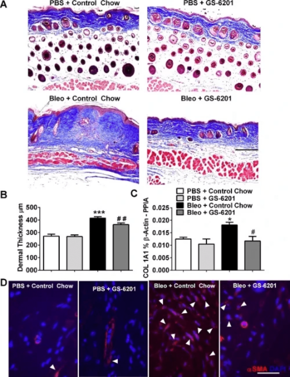 Adenosine signaling in dermal fibrosis Adenosine signaling in dermal fibrosis