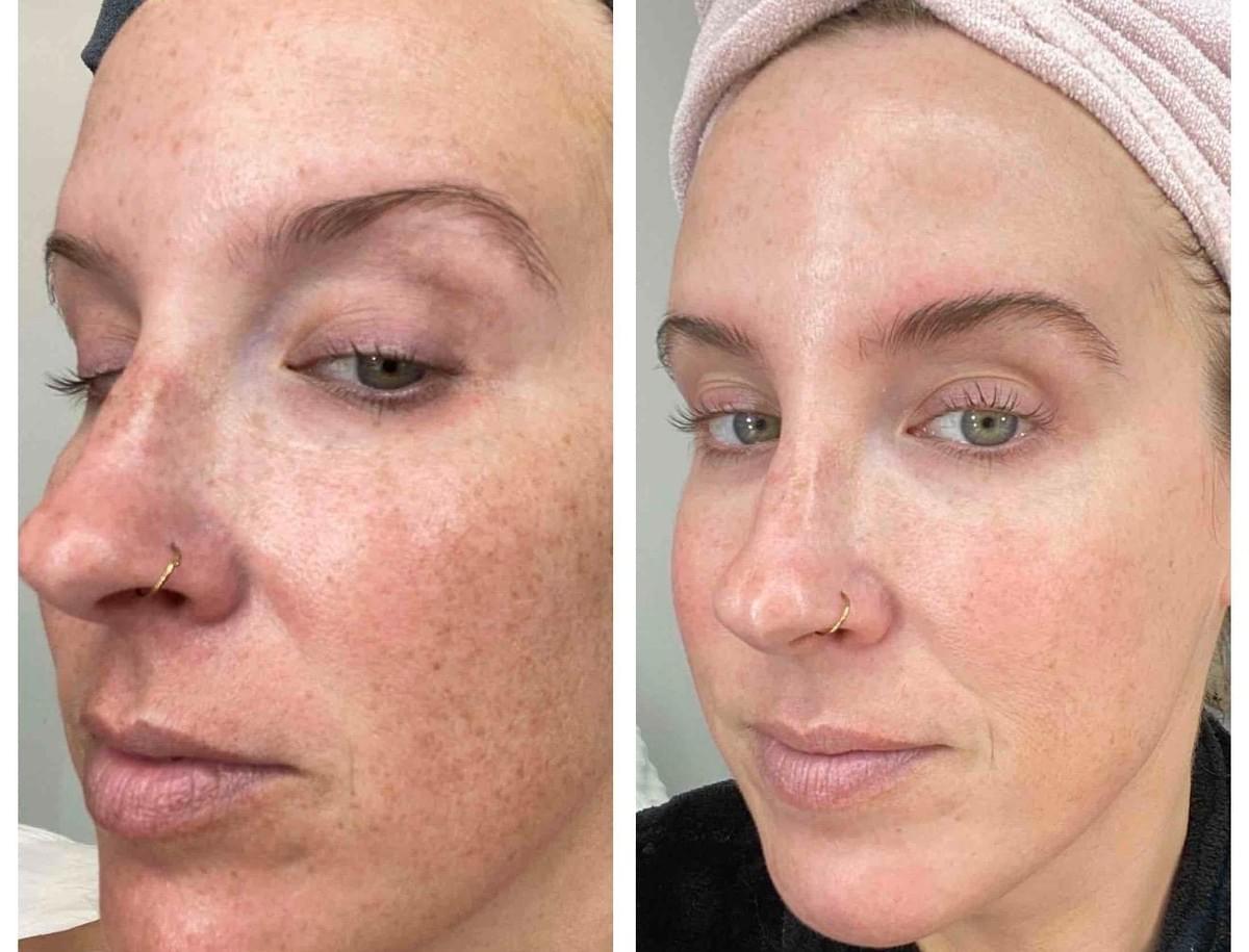 Dr Dennis Gross Skincare™ - klinisk hudvård, unika resultat