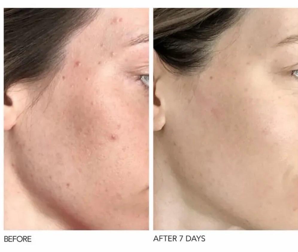 Dr Dennis Gross Skincare™ - klinisk hudvård, unika resultat