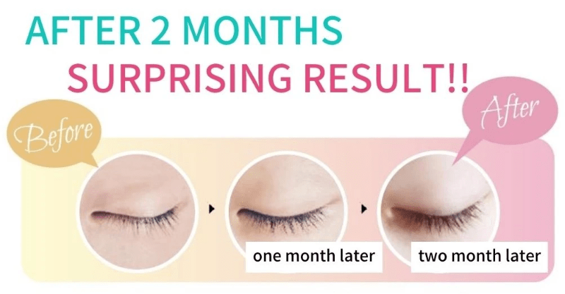 eye serum human stem cells extract fine wrinkles eye serum human stem cells extract fine wrinkles