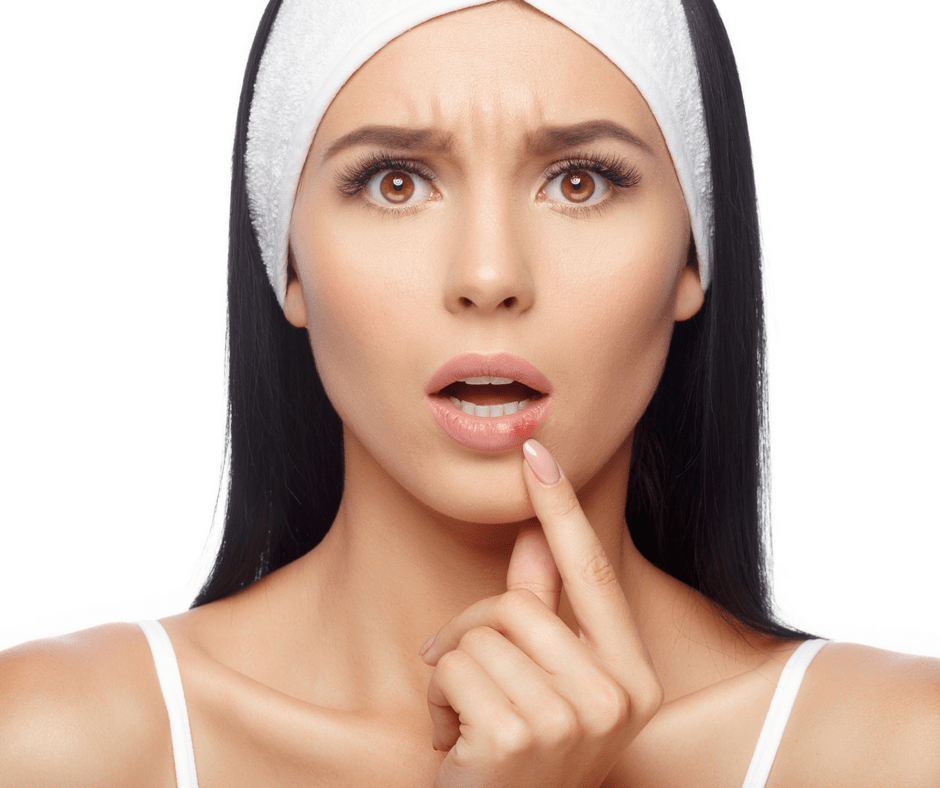 Attractive Upset Young Woman with a Cold Sore on Lower Lip Attractive Upset Young Woman with a Cold Sore on Lower Lip