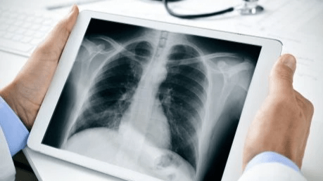 認識COPD 慢阻肺病 認識COPD 慢阻肺病