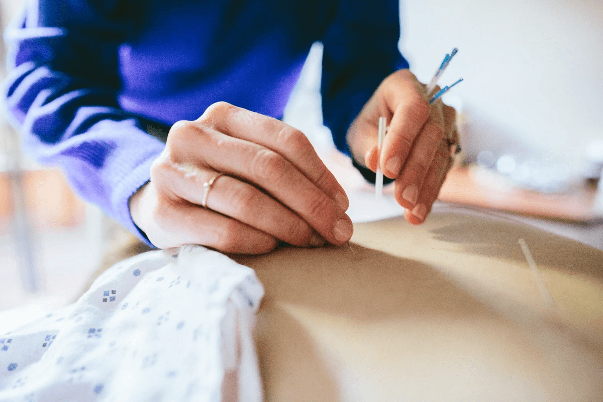 Acupuncture treatment Acupuncture treatment