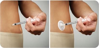 insulin port for insulin injections the spike app insulin port for insulin injections the spike app