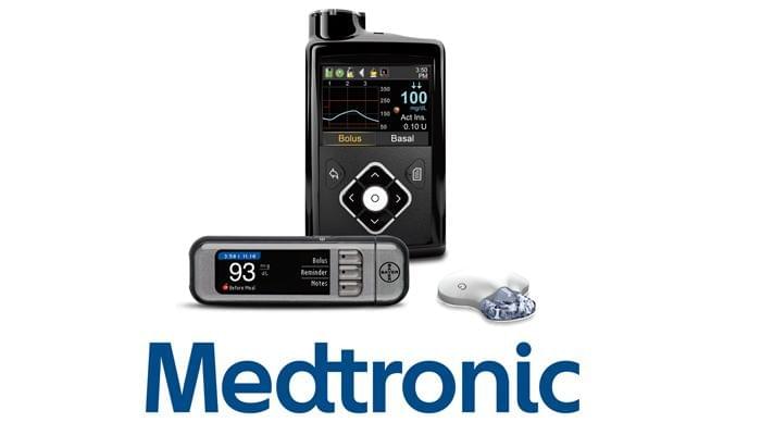 medtronic insulin pump and CGM to regulate type 1 diabetes blood sugar and insulin delivery medtronic insulin pump and CGM to regulate type 1 diabetes blood sugar and insulin delivery