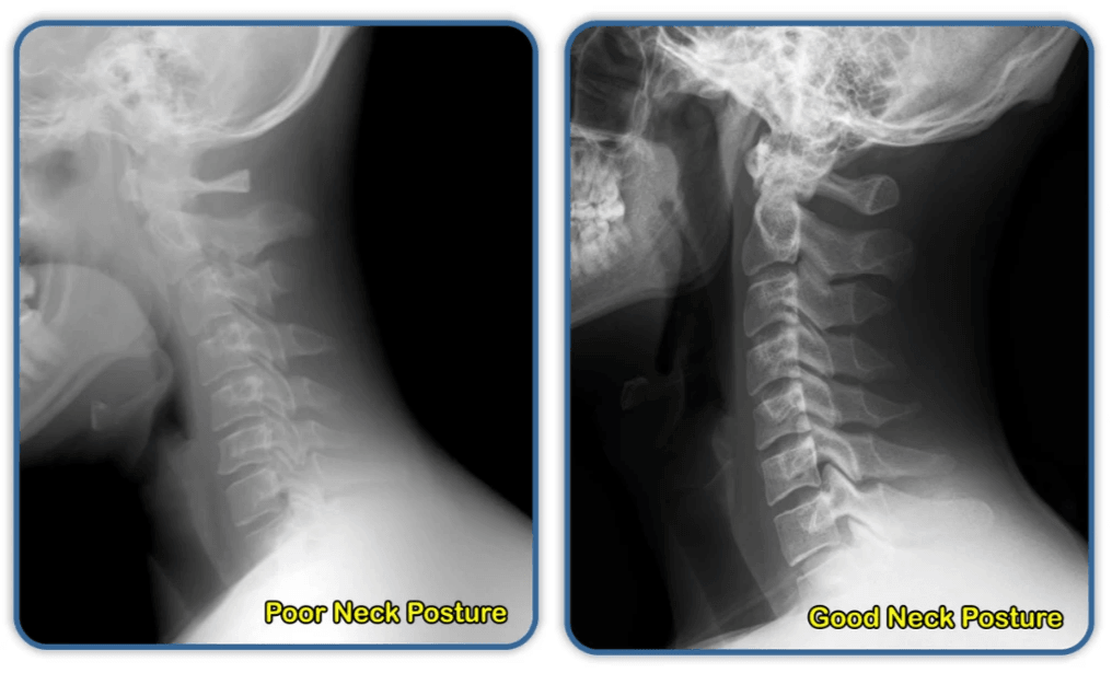 Section image