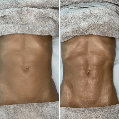 Woman receiving a Remedial Massage at Atma Wellbeing by Saura Rates Woman receiving a Remedial Massage at Atma Wellbeing by Saura Rates