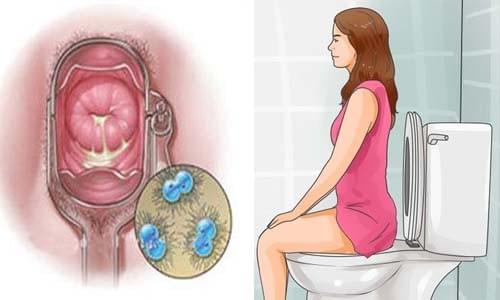 triệu chứng bệnh lậu ở nữ giới triệu chứng bệnh lậu ở nữ giới