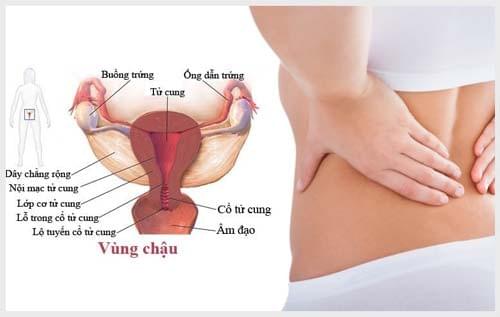 Hình ảnh viêm vùng chậu Hình ảnh viêm vùng chậu