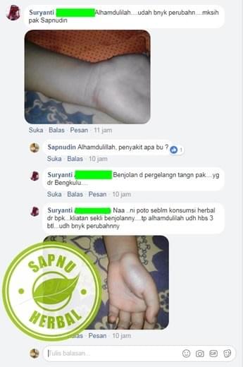 Obat Sekelan Di Apotik / Apotek 100% Alami Jeung Ampuh Tanpa Operasi Obat Sekelan Di Apotik / Apotek 100% Alami Jeung Ampuh Tanpa Operasi