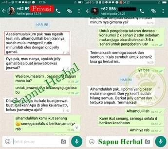 Obat Sekelan Di Apotik / Apotek 100% Alami Jeung Ampuh Tanpa Operasi Obat Sekelan Di Apotik / Apotek 100% Alami Jeung Ampuh Tanpa Operasi