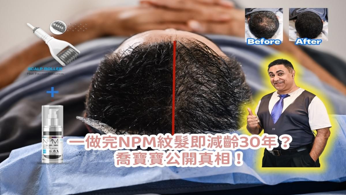 喬寶寶紋髮推薦|香港TOP 1 紋髮技術,真實紋髮體驗分享 喬寶寶紋髮推薦|香港TOP 1 紋髮技術,真實紋髮體驗分享