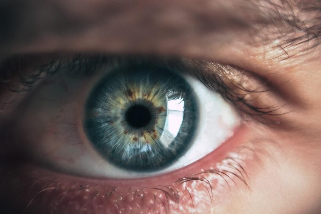 broken image