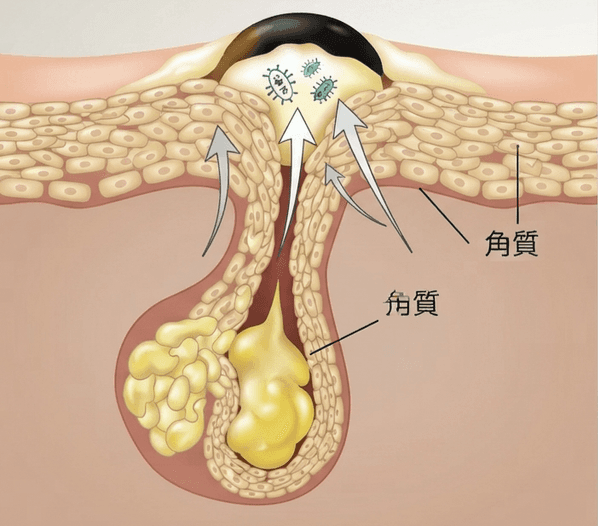 Section image