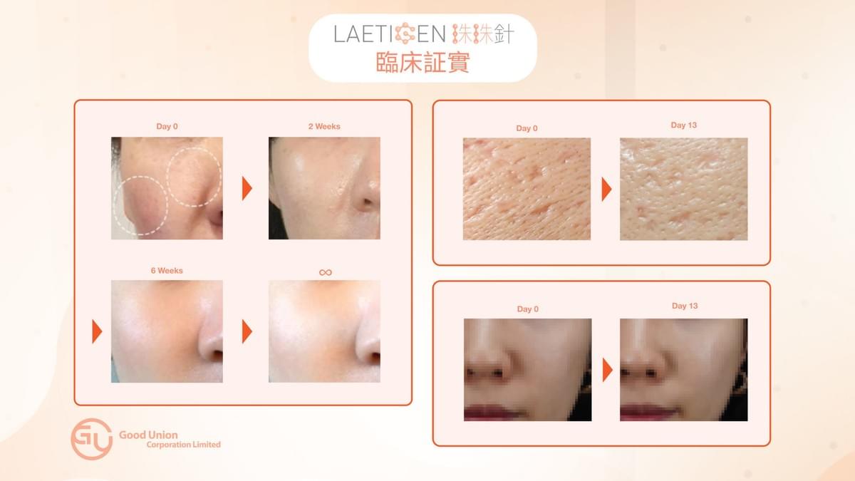 Professional medical beauty, show confidence's beauty Please create a one-page official website for a Hong Kong medical beauty brand.
Brand Name: Dr.Afterhour
Brand Subtitle: Afternoon Care Center
Brand Type: Medical Beauty Center
Website Language: Mainly Traditional Chinese, treatment names can be kept in English.
Target Audience: Women in Hong Kong aged 25–50 who focus on anti-aging, contour enhancement, skin quality improvement, and body management.
Please establish the following sections:
1. Hero Banner
2. About Brand Introduction
3. Treatments Categories
4. Featured Treatments
5. Why Choose Us
6. Consultation CTA
7. Contact Us
Main website goal:
Build a high-end medical aesthetic brand image, clearly display treatment categories, and guide customers to WhatsApp for inquiries and appointment assessments. Professional medical beauty, show confidence's beauty Please create a one-page official website for a Hong Kong medical beauty brand.
Brand Name: Dr.Afterhour
Brand Subtitle: Afternoon Care Center
Brand Type: Medical Beauty Center
Website Language: Mainly Traditional Chinese, treatment names can be kept in English.
Target Audience: Women in Hong Kong aged 25–50 who focus on anti-aging, contour enhancement, skin quality improvement, and body management.
Please establish the following sections:
1. Hero Banner
2. About Brand Introduction
3. Treatments Categories
4. Featured Treatments
5. Why Choose Us
6. Consultation CTA
7. Contact Us
Main website goal:
Build a high-end medical aesthetic brand image, clearly display treatment categories, and guide customers to WhatsApp for inquiries and appointment assessments.